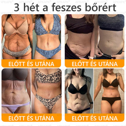 Magyarországon gyártva és szállítva ✨✨ 𝖠𝖯𝖪𝖠𝖯𝖪® Méhméreg tartalmú bőrmegújító krém