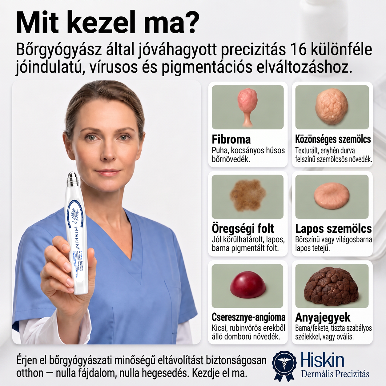 💙💙Hivatalos Márkabolt | 🚢 Hiskin® 7 napos Szemölcseltávolító Roll-on Ápoló Folyadék (Fájdalommentes rollerball technológia, hegek nélkül) 🐬