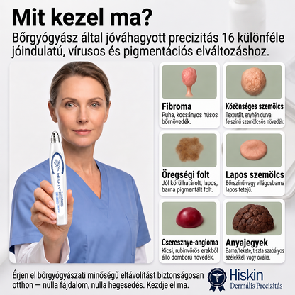 💙💙Hivatalos Márkabolt | 🚢 Hiskin® 7 napos Szemölcseltávolító Roll-on Ápoló Folyadék (Fájdalommentes rollerball technológia, hegek nélkül) 🐬