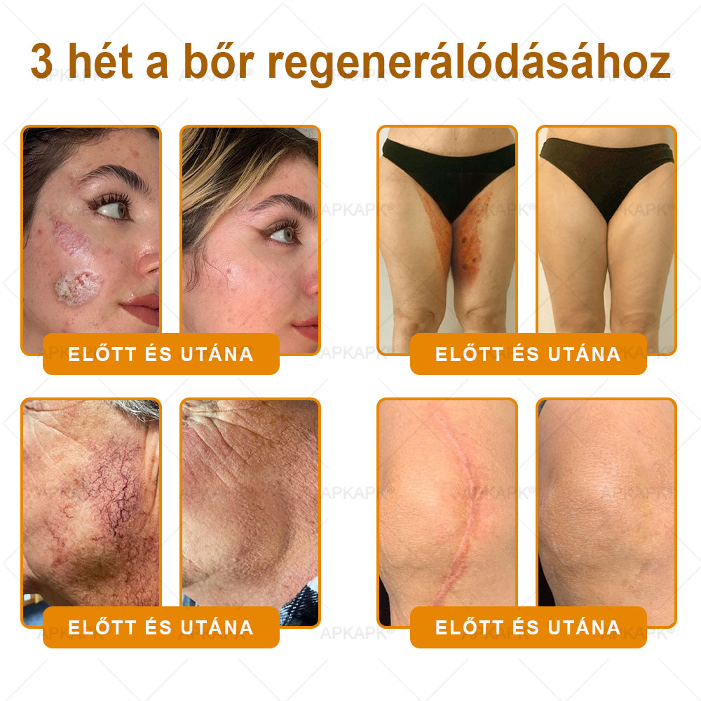 Magyarországon gyártva és szállítva ✨✨ 𝖠𝖯𝖪𝖠𝖯𝖪® Méhméreg tartalmú bőrmegújító krém