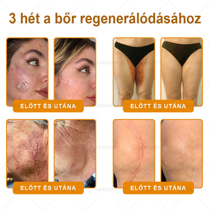 Magyarországon gyártva és szállítva ✨✨ 𝖠𝖯𝖪𝖠𝖯𝖪® Méhméreg tartalmú bőrmegújító krém