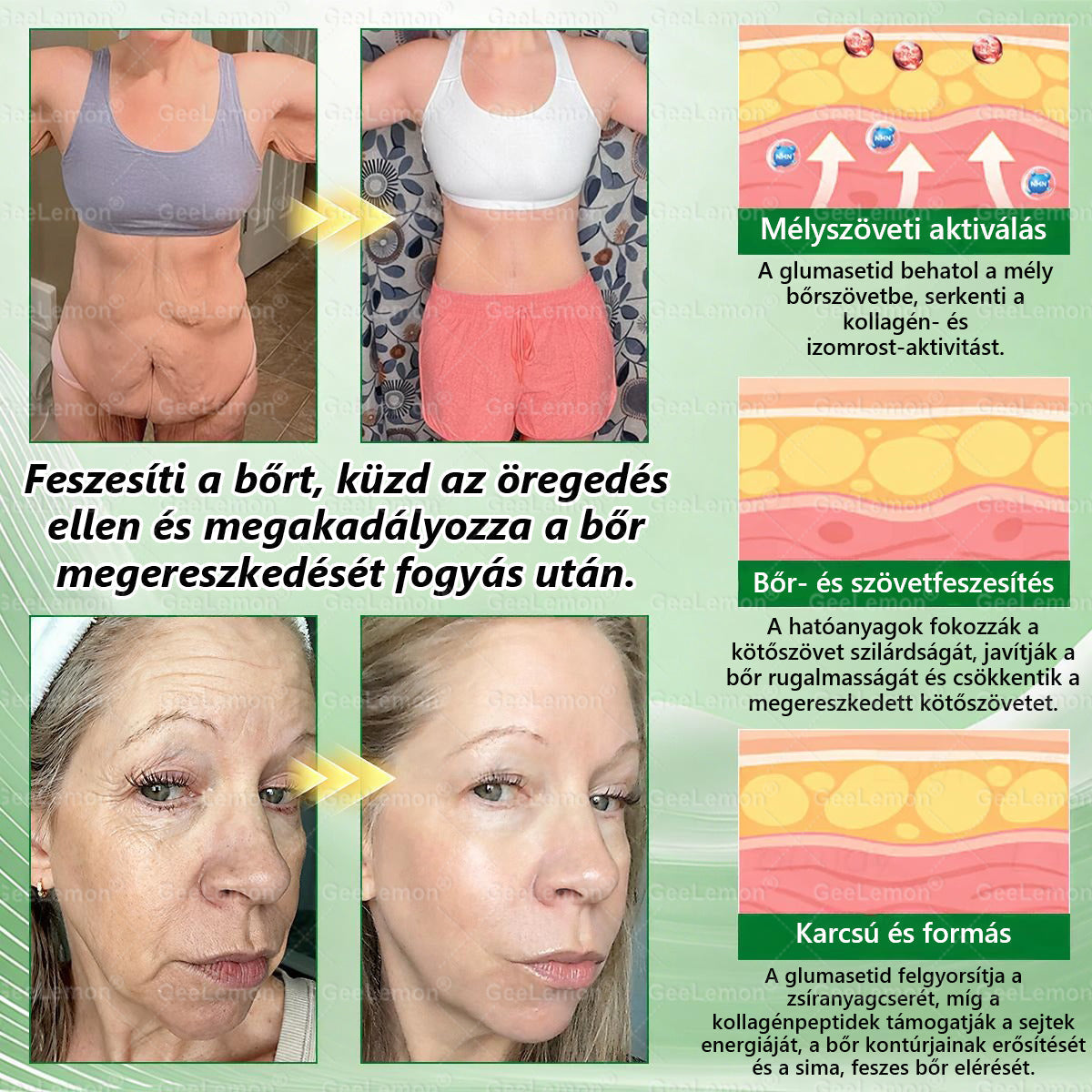 ❤️❤️ Moringa · Berberine × NAD+ 10 az 1-ben GeeLemon® Prémium Nano Mikrotűs Tapasz Napi 1 alkalmazás • Akár már 7 nap után látható változás✨ 💚 Az alakformálás, az energiaszint, az étvágykontroll és az általános jó közérzet mindennapi támogatására