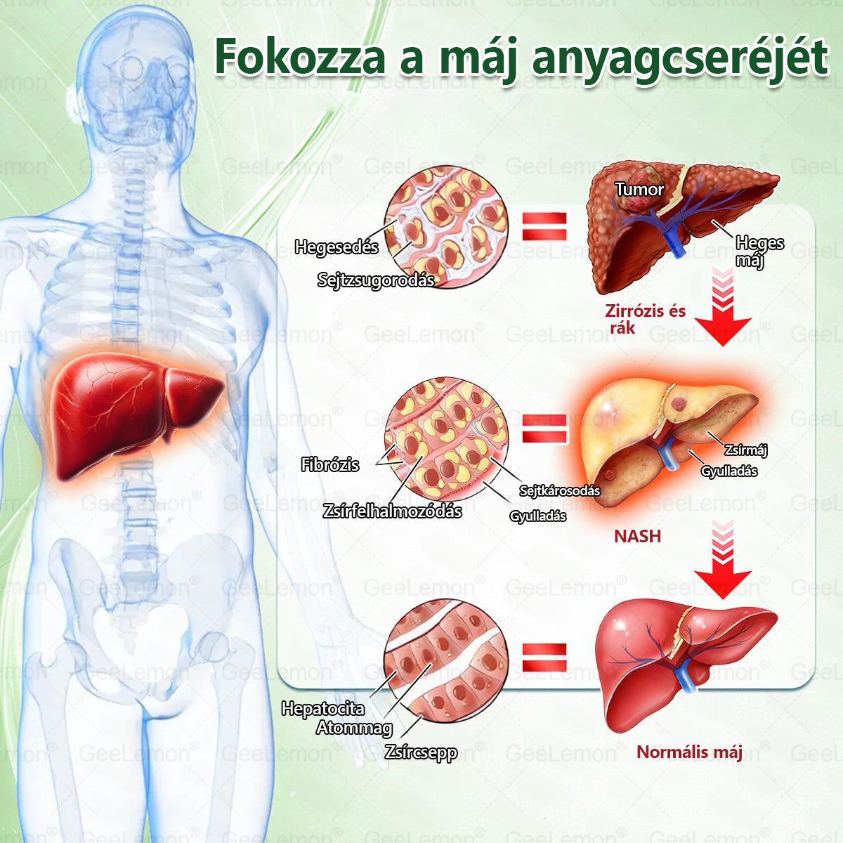 ❤️❤️ Moringa · Berberine × NAD+ 10 az 1-ben GeeLemon® Prémium Nano Mikrotűs Tapasz Napi 1 alkalmazás • Akár már 7 nap után látható változás✨ 💚 Az alakformálás, az energiaszint, az étvágykontroll és az általános jó közérzet mindennapi támogatására