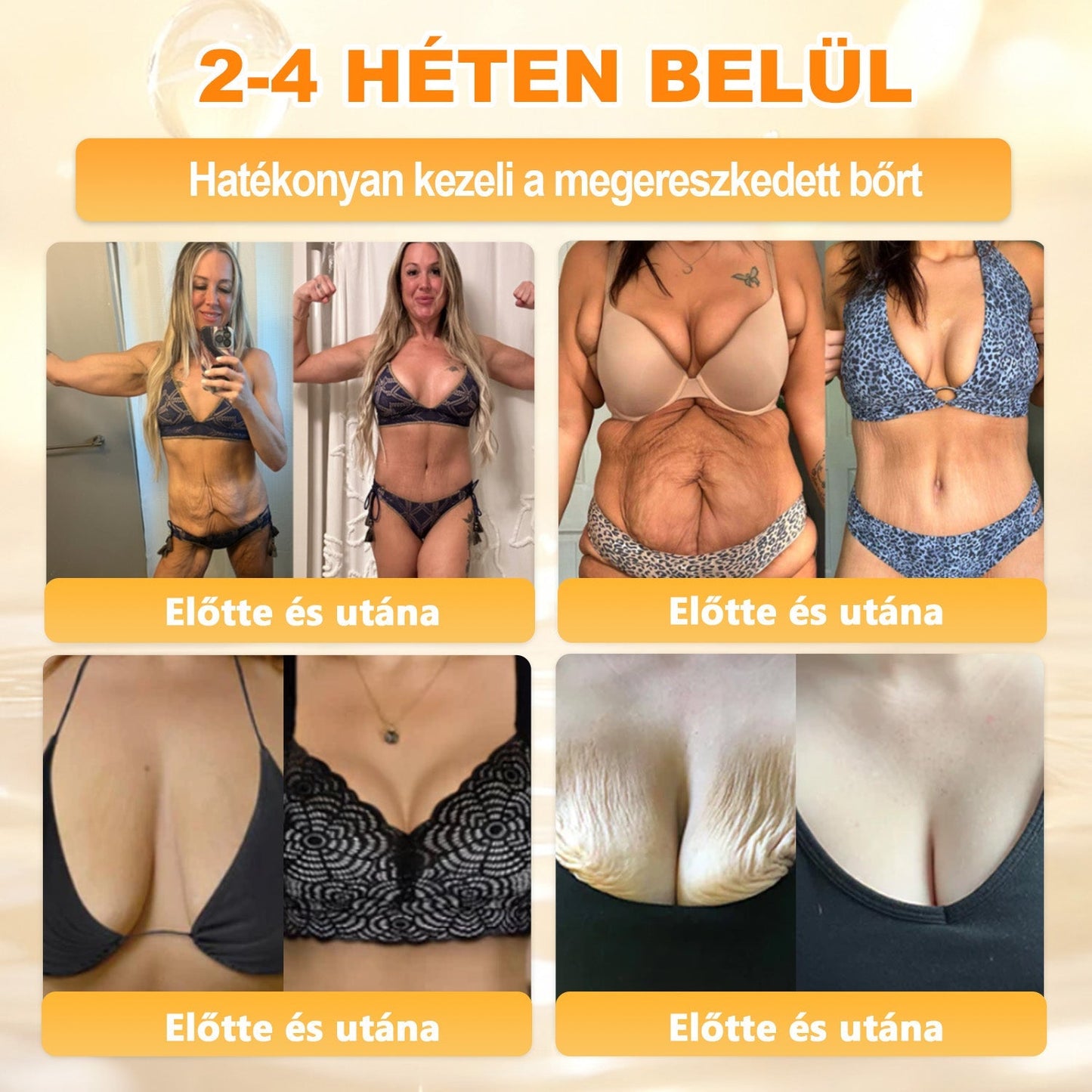 Ajánlott a Semmelweis Kórház által · BENU hivatalos üzlet✨✨ 𝖠𝖯𝖪𝖠𝖯𝖪® méhméreges bőrmegújító krém