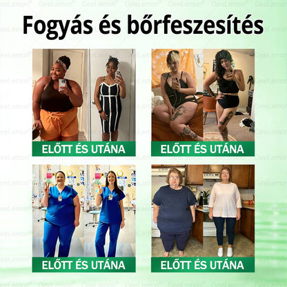 ❤️❤️ Moringa · Berberine × NAD+ 10 az 1-ben GeeLemon® Prémium Nano Mikrotűs Tapasz Napi 1 alkalmazás • Akár már 7 nap után látható változás✨ 💚 Az alakformálás, az energiaszint, az étvágykontroll és az általános jó közérzet mindennapi támogatására