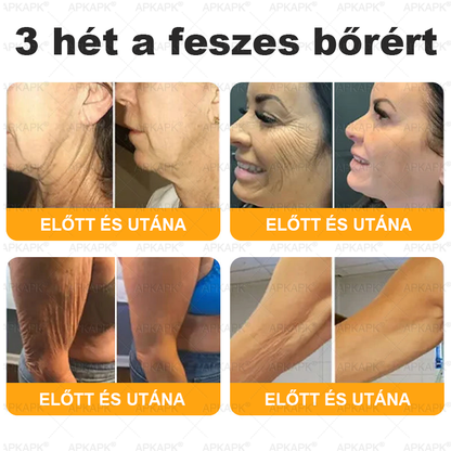Magyarországon gyártva és szállítva ✨✨ 𝖠𝖯𝖪𝖠𝖯𝖪® Méhméreg tartalmú bőrmegújító krém