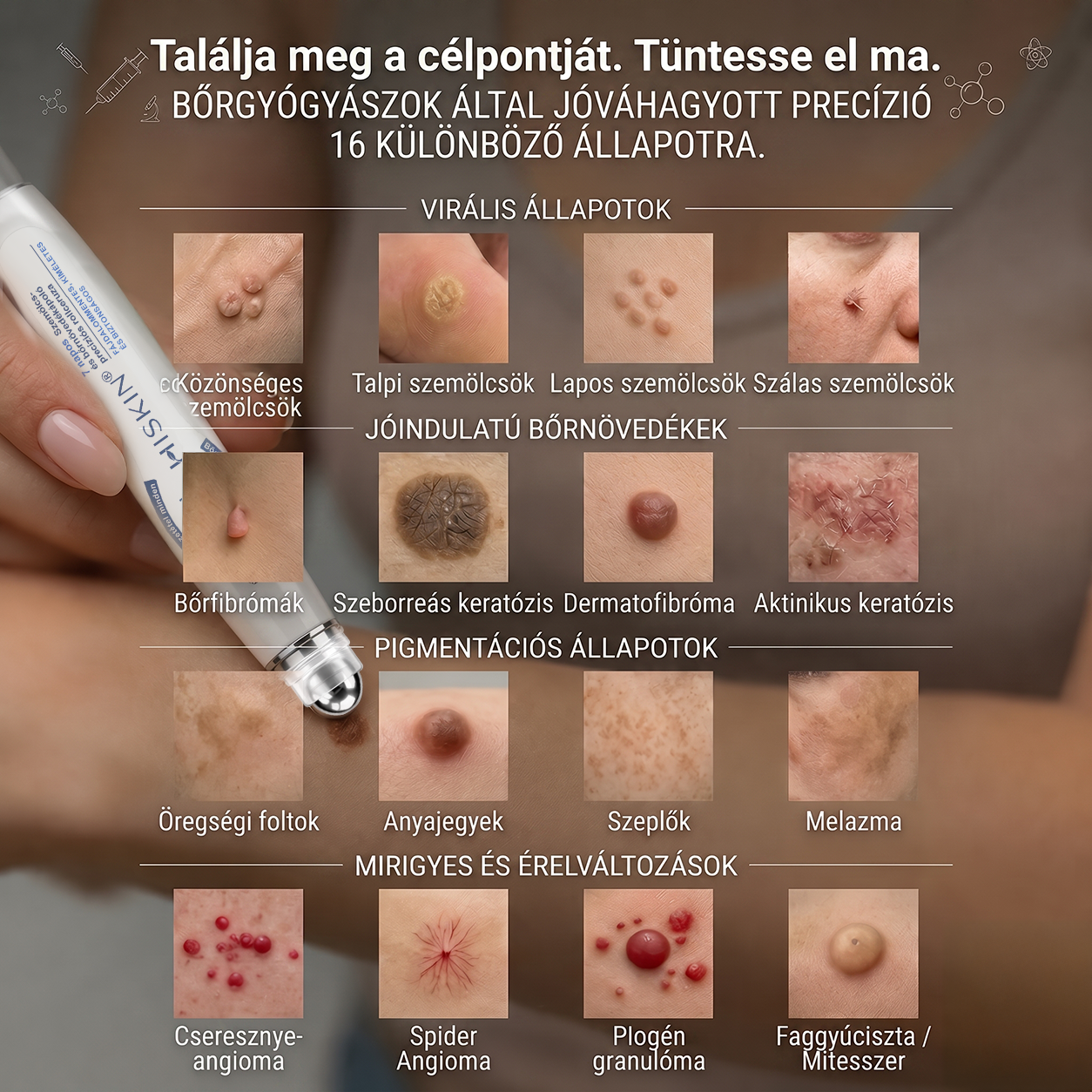 👩‍⚕️👩‍⚕️Hivatalos Márkabolt | 🚢🚢 Hiskin® 7 napos Szemölcseltávolító Roll-on Ápoló Folyadék (Fájdalommentes rollerball technológia, hegek nélkül) 🐬
