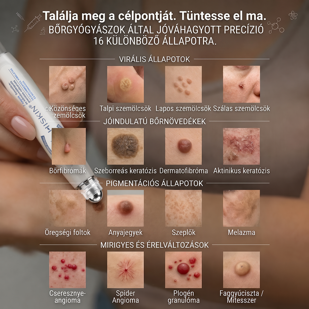 💙💙Hivatalos Márkabolt | 🚢 Hiskin® 7 napos Szemölcseltávolító Roll-on Ápoló Folyadék (Fájdalommentes rollerball technológia, hegek nélkül) 🐬