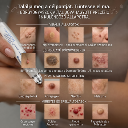 💙💙Hivatalos Márkabolt | 🚢 Hiskin® 7 napos Szemölcseltávolító Roll-on Ápoló Folyadék (Fájdalommentes rollerball technológia, hegek nélkül) 🐬