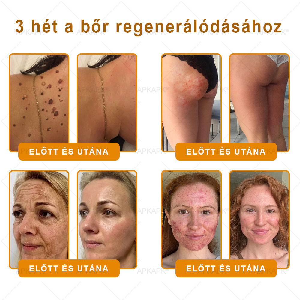 Ajánlott a Semmelweis Kórház által · BENU hivatalos üzlet✨✨ 𝖠𝖯𝖪𝖠𝖯𝖪® méhméreges bőrmegújító krém