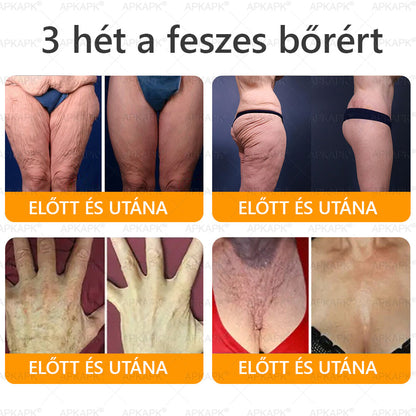 Magyarországon gyártva és szállítva ✨✨ 𝖠𝖯𝖪𝖠𝖯𝖪® Méhméreg tartalmú bőrmegújító krém