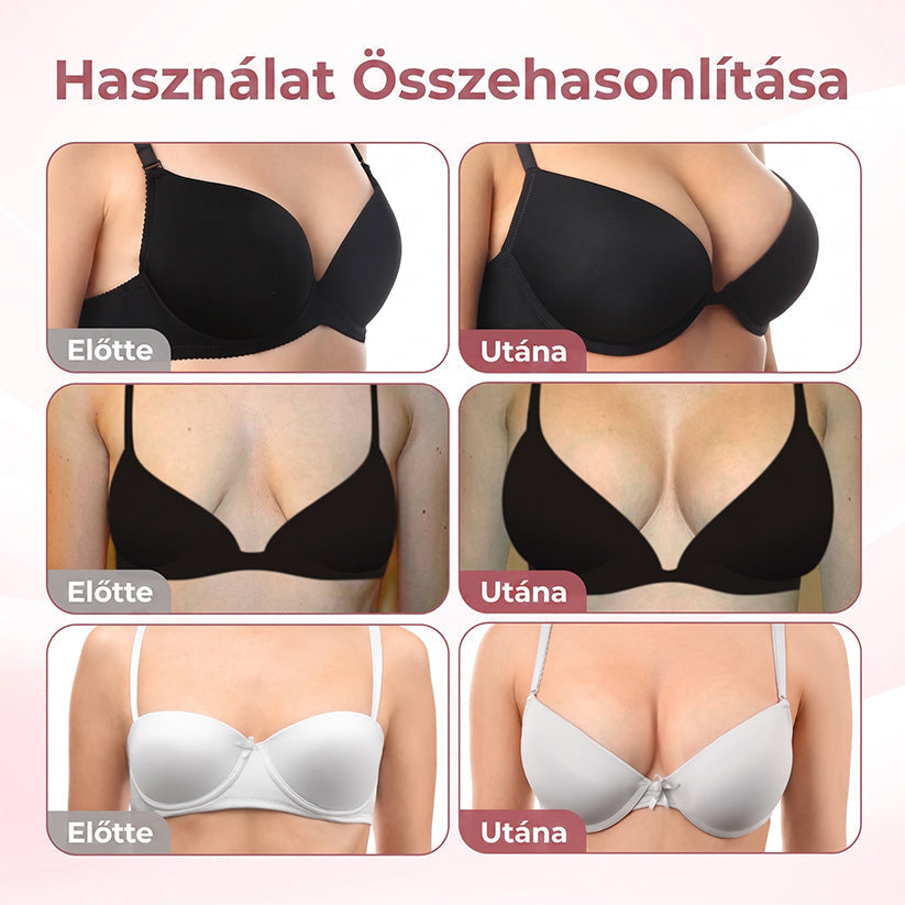 🏅🏅HISKIN® MELLEMELŐ ÉS FESZESÍTŐ MIKROTŰS TAPASZOK