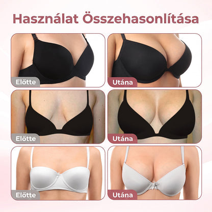 🏅🏅HISKIN® MELLEMELŐ ÉS FESZESÍTŐ MIKROTŰS TAPASZOK