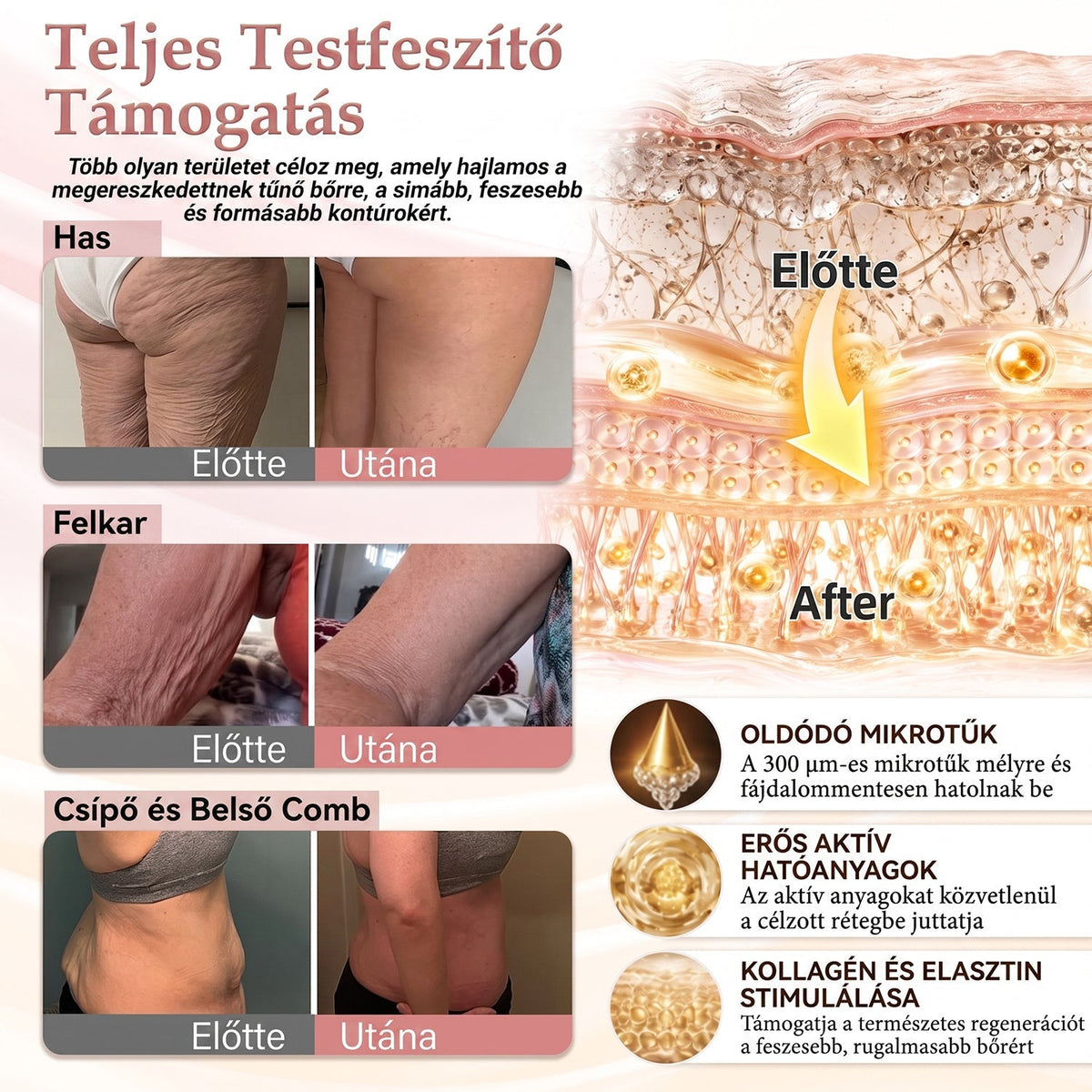 🏅🏅HISKIN® MELLEMELŐ ÉS FESZESÍTŐ MIKROTŰS TAPASZOK