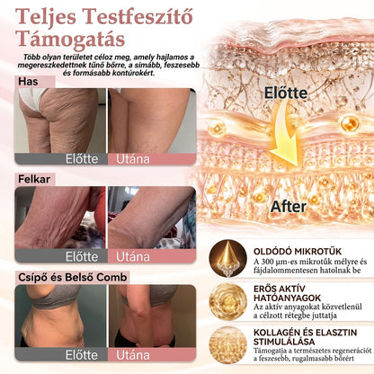 🏅🏅HISKIN® MELLEMELŐ ÉS FESZESÍTŐ MIKROTŰS TAPASZOK