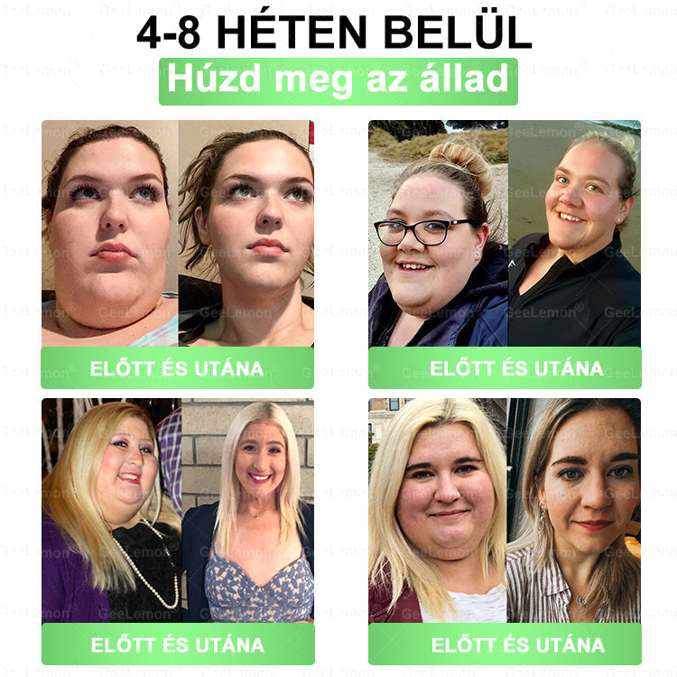 ❤️❤️ Moringa · Berberine × NAD+ 10 az 1-ben GeeLemon® Prémium Nano Mikrotűs Tapasz Napi 1 alkalmazás • Akár már 7 nap után látható változás✨ 💚 Az alakformálás, az energiaszint, az étvágykontroll és az általános jó közérzet mindennapi támogatására