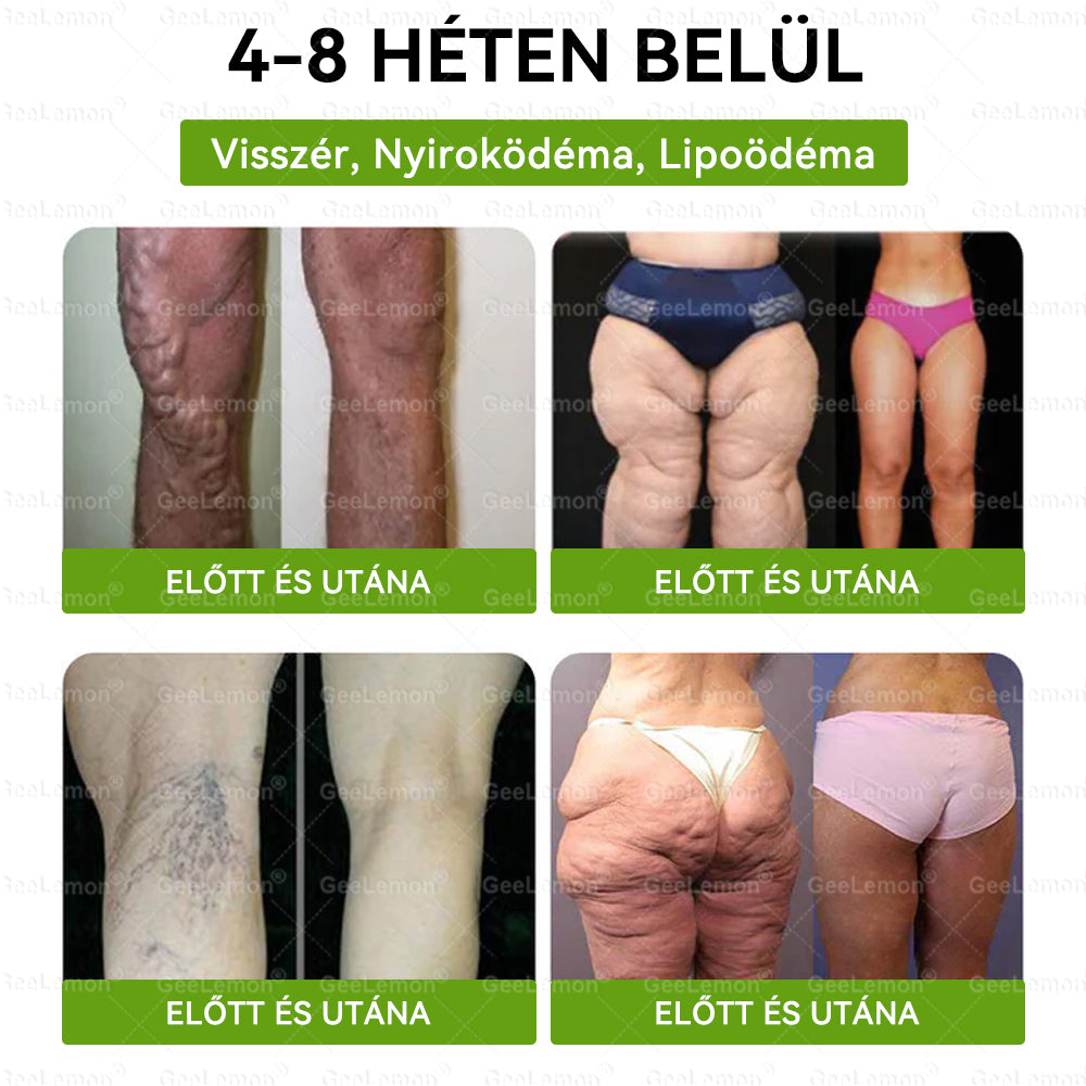 ❤️❤️ Moringa · Berberine × NAD+ 10 az 1-ben GeeLemon® Prémium Nano Mikrotűs Tapasz Napi 1 alkalmazás • Akár már 7 nap után látható változás✨ 💚 Az alakformálás, az energiaszint, az étvágykontroll és az általános jó közérzet mindennapi támogatására