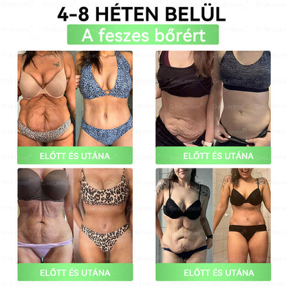❤️❤️ Moringa · Berberine × NAD+ 10 az 1-ben GeeLemon® Prémium Nano Mikrotűs Tapasz Napi 1 alkalmazás • Akár már 7 nap után látható változás✨ 💚 Az alakformálás, az energiaszint, az étvágykontroll és az általános jó közérzet mindennapi támogatására