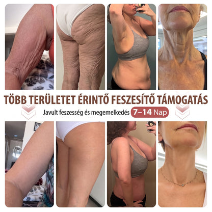 🏅🏅HISKIN® MELLEMELŐ ÉS FESZESÍTŐ MIKROTŰS TAPASZOK